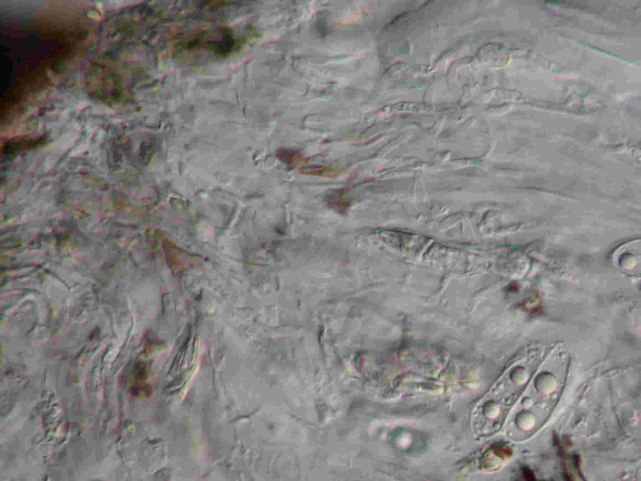[Collemopsidium caesium]